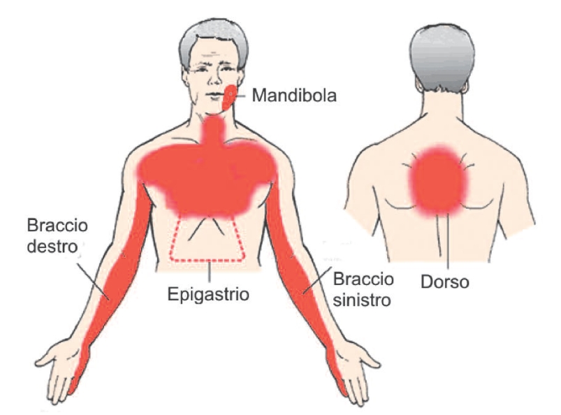 La spina dorsale osteochondrosis male attacca